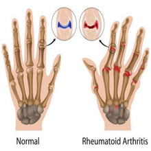 Load image into Gallery viewer, Compression Therapy Active Gloves - Copper Hands